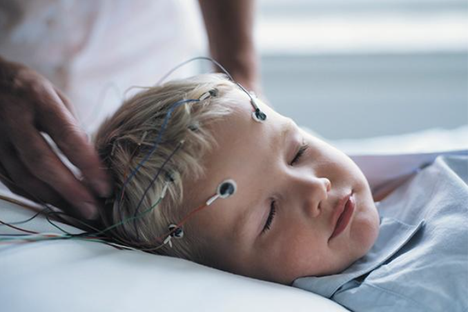 Ambu EEG EP PSG
