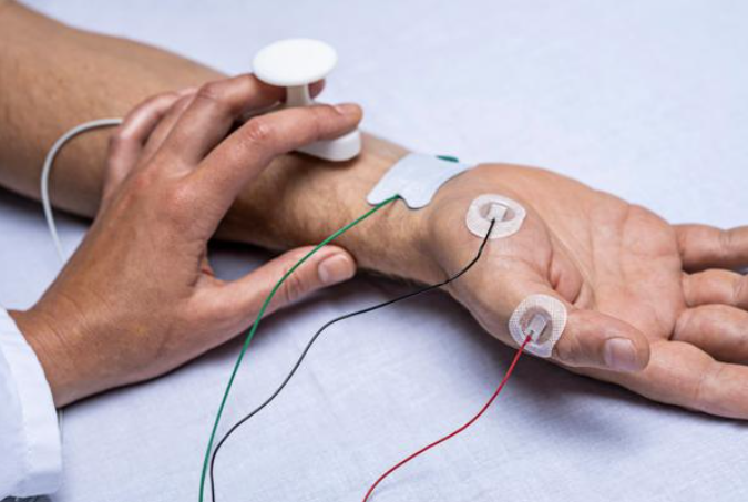 Ambu EMG NCS