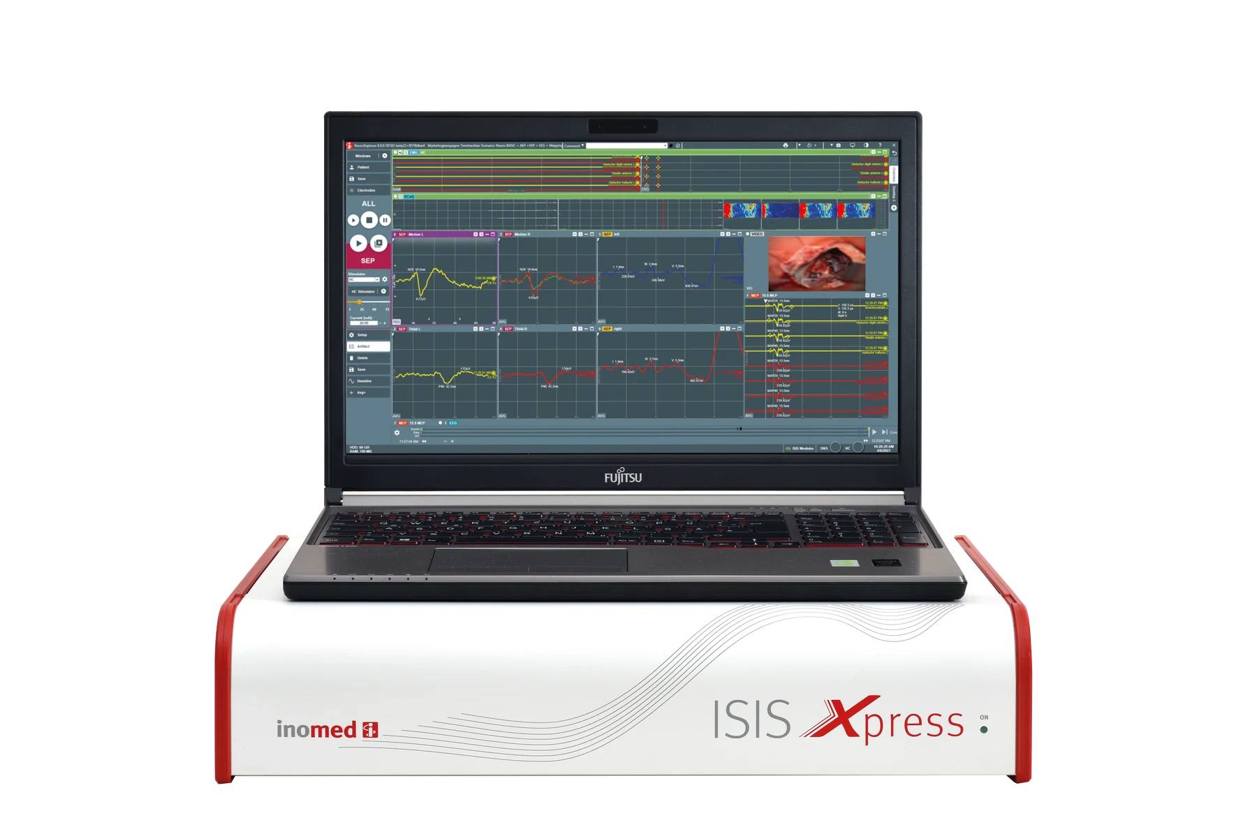 inomed ISIS Xpress System with NeuroExplorer